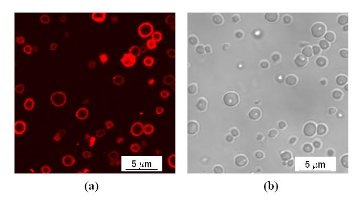 Portwine stain image