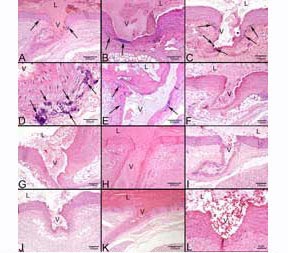 vkorc1 mutant rats display calcification of the aorta walls 